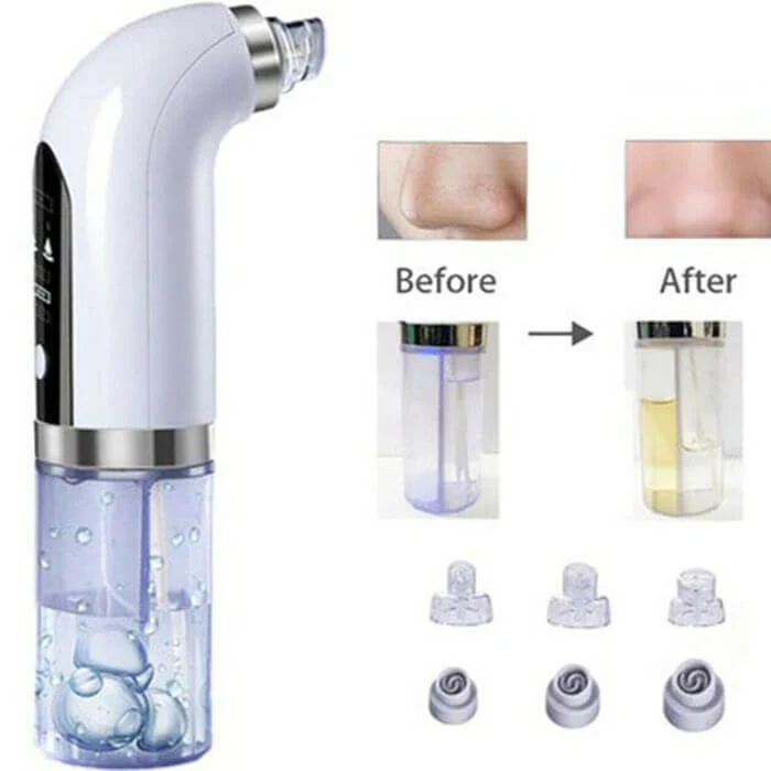 iBeauty Vacuum Facial Cleaner and Vacuum For Blackheads - Image 7