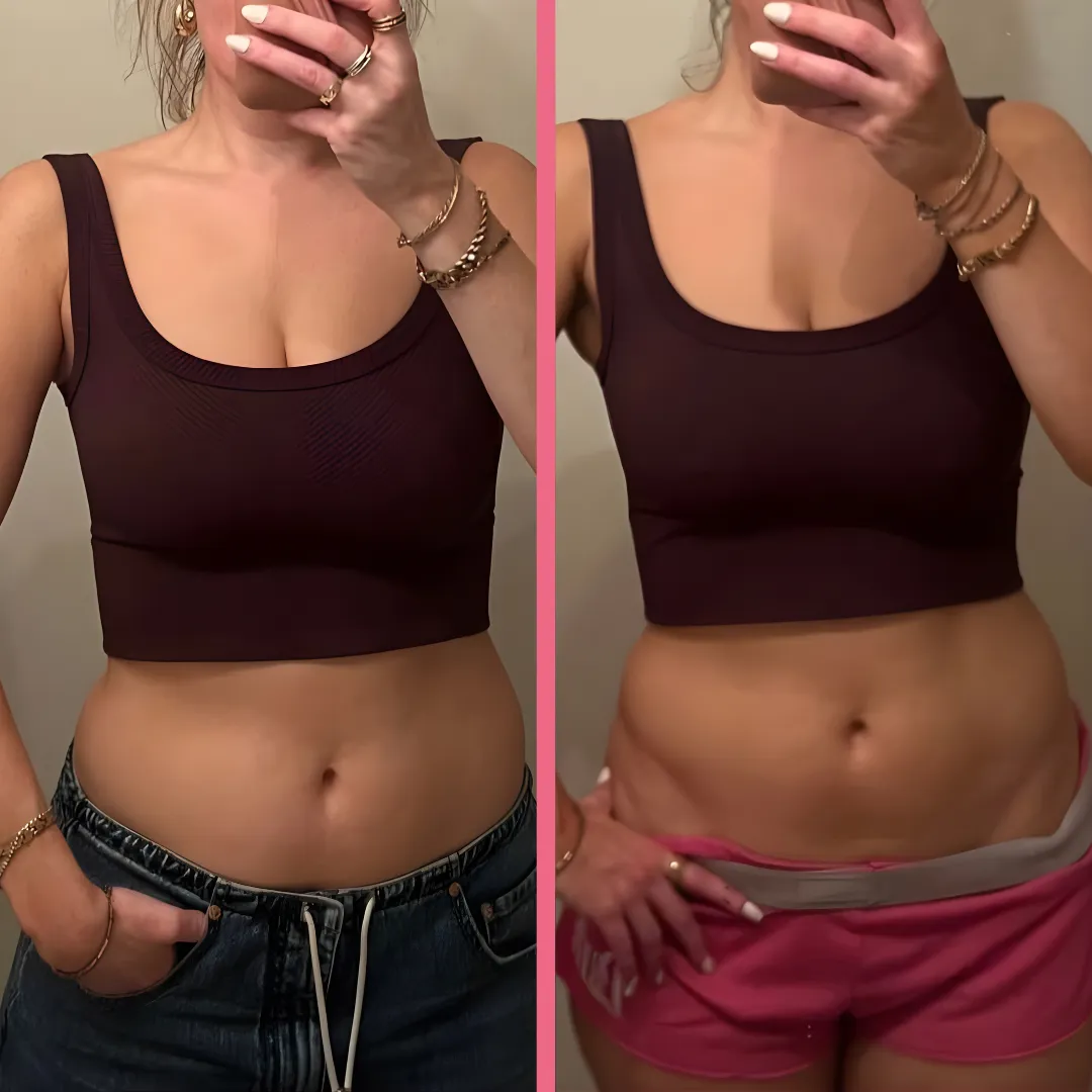 SculptPro™ 3-in-1 Skin Firming & Cellulite Massager - Image 10