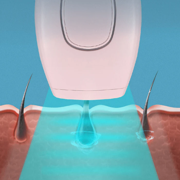 GlowPro IPL Laser Facial & Whole Body Hair Removal Handset - Image 4