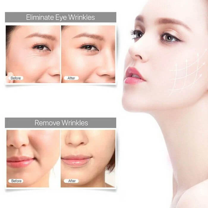 Ultrasonic Rejuvenation Facial Skin Care Therapy Massager - Image 3